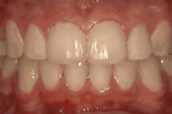 Before