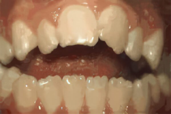 After