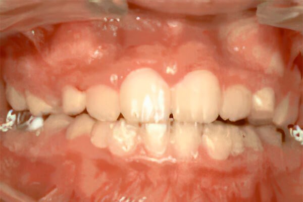 Before